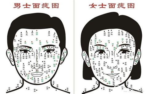 腳側有痣|脚痣的位置与命运图解大全 脚下有痣哪个位置最好